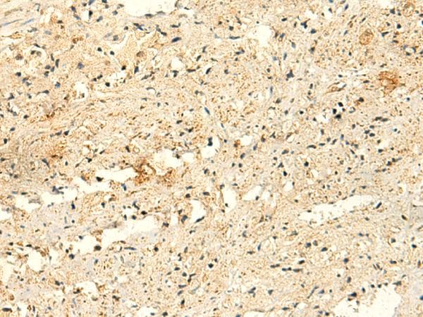 GLYATL2 Antibody