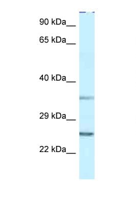 IPP2 / PPP1R2 Antibody (aa27-76)