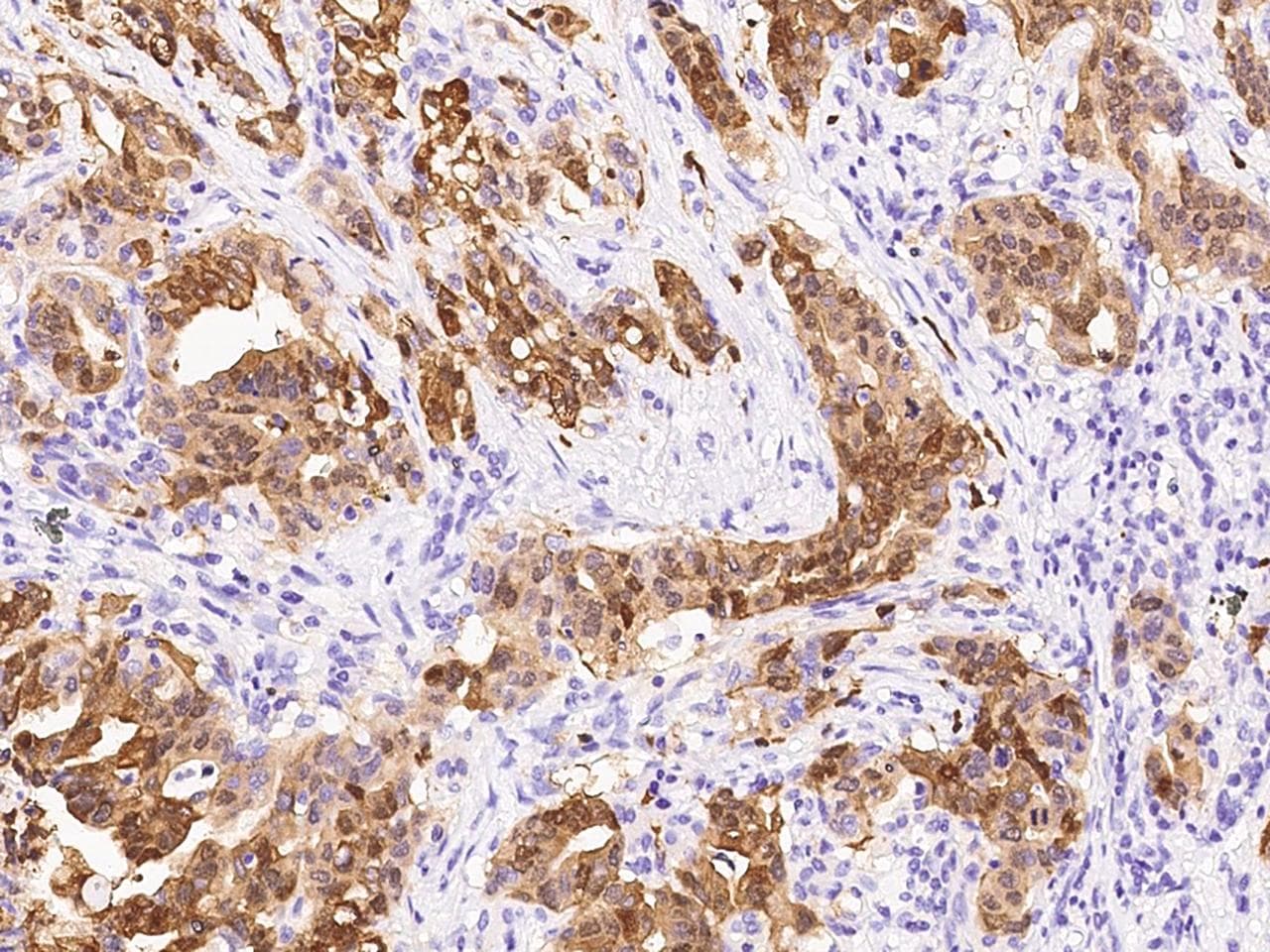 S100P Antibody (Preservative Free)