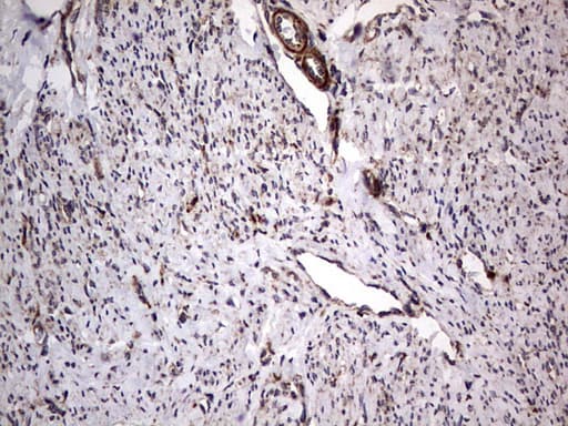 Monoclonal Mouse anti-Human MTDH / Metadherin Antibody (clone OTI2H4, aa70-582, IHC, WB)