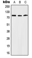 ANOS1 / Anosmin Antibody (Internal)
