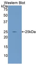 GCLC Antibody (aa435-636)