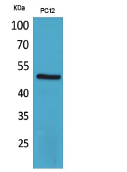 CRFR1 / CRHR1 Antibody