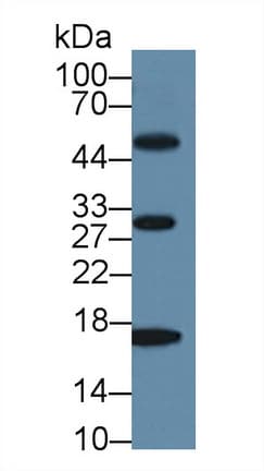 MB / Myoglobin Antibody (aa1-154, APC)