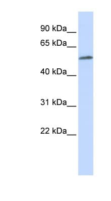 Polyclonal Rabbit anti-Human MEIS2 Antibody (aa180-229, WB)