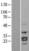 SOST / Sclerostin Protein (Over-Expression Lysate Myc-DDK (Flag))