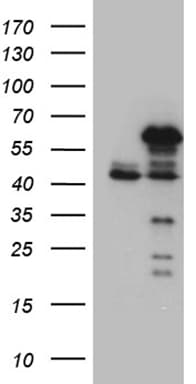 NFKBIE / IKB Epsilon Antibody (clone OTI4F7, Carrier-free)
