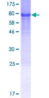 Human GDAP2 Protein (Recombinant GST)