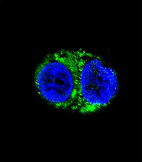 PathPlus™ IDH1 / IDH Antibody (aa116-143)