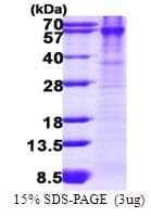 Human BLK Protein (Recombinant His)