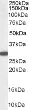 IHC-plus™ NQO1 Antibody (aa263-274)