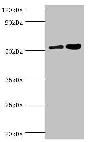 Polyclonal Rabbit anti-Human DPP2 / DPP7 Antibody (aa190-410, IHC, WB)