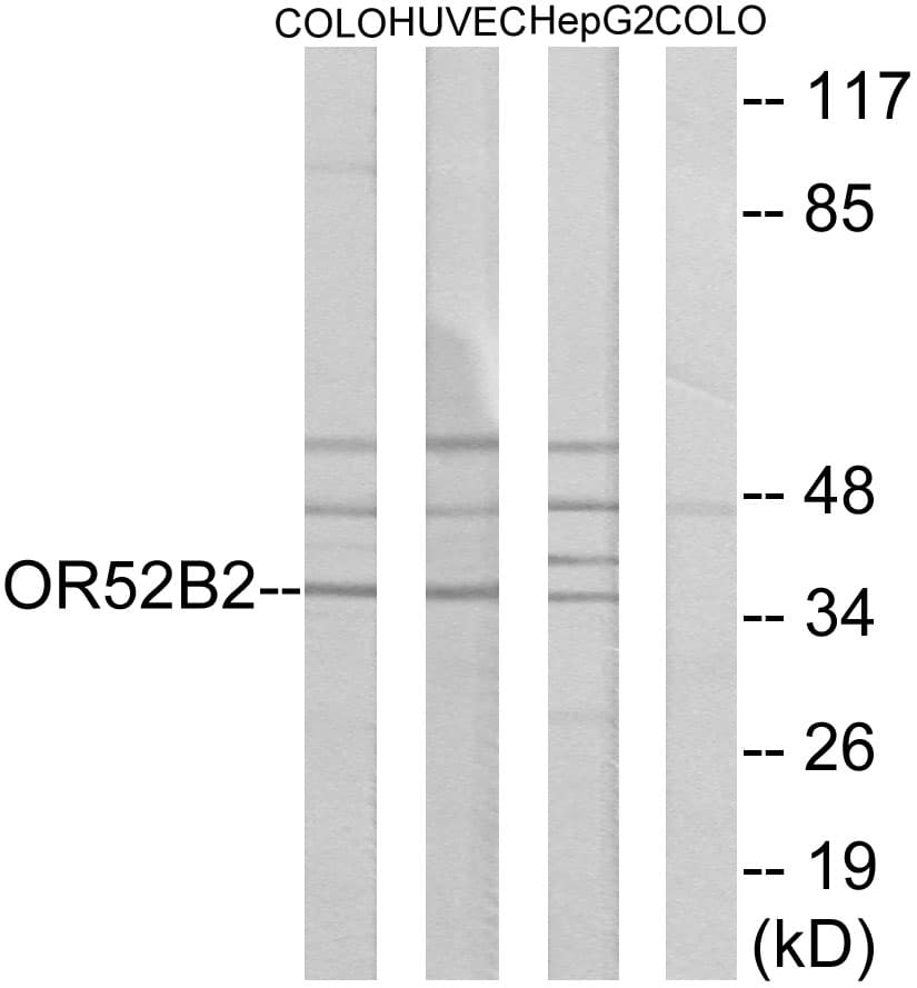 OR52B2 Antibody (aa201-250)