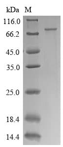 Human CTPS Protein (Recombinant 6His, N-terminus)