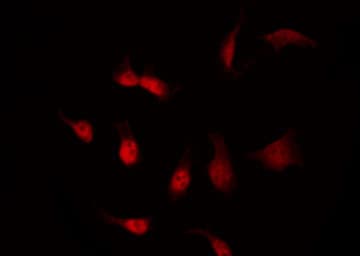 CDK8 Antibody