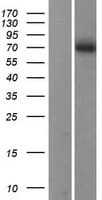 SMPD1 / Acid Sphingomyelinase Protein (Over-Expression Lysate Myc-DDK (Flag))