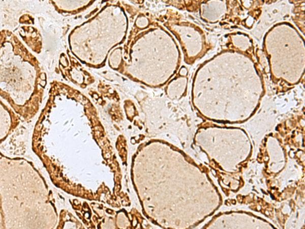 LYRM1 Antibody