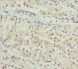 PACSIN2 Antibody