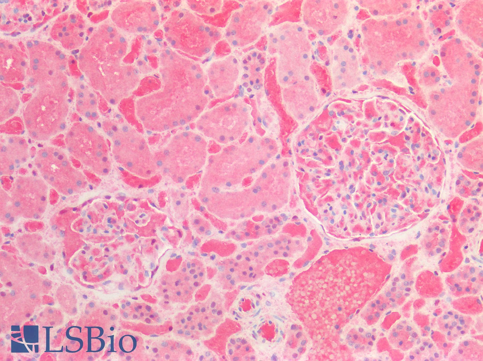 IHC-plus™ Polyclonal Sheep anti-Human Alpha-1-Antichymotrypsin Antibody (IHC)