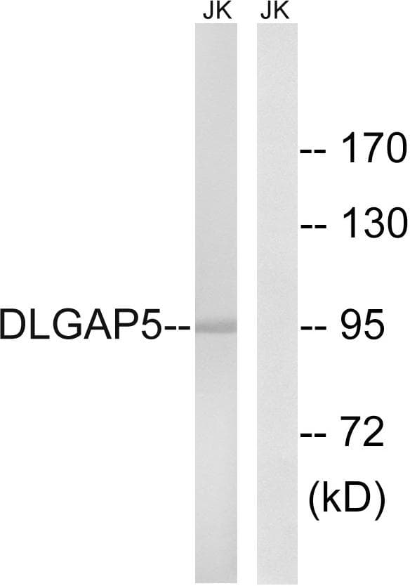 Polyclonal Rabbit anti-Human HURP / DLGAP5 Antibody (WB)
