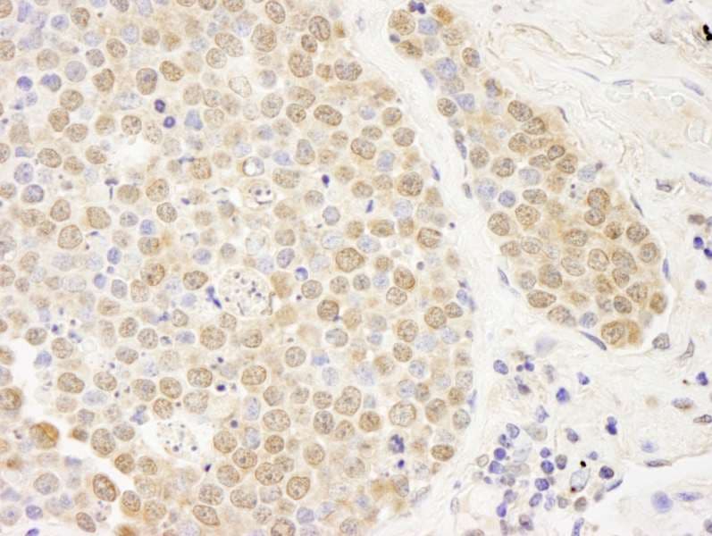Polyclonal Rabbit anti-Human PARP10 Antibody (aa300-350, IHC)