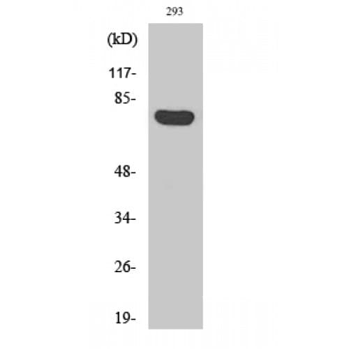 Polyclonal Rabbit anti-Human ARHGAP18 Antibody (490-570 aa, C-terminal, IHC, WB)