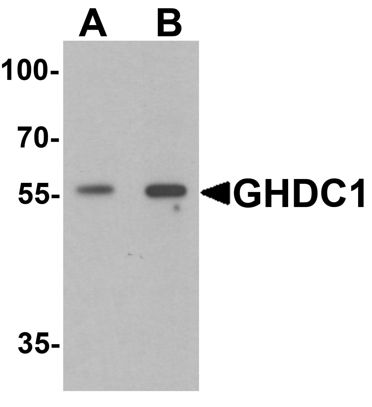 IHC-plus™ Polyclonal Rabbit anti-Human GHDC Antibody (IHC, IF, WB)