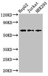 Polyclonal Rabbit anti-Human CD96 / TACTILE Antibody (IHC, IF)