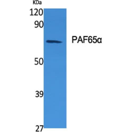 TAF6L Antibody (1-80 aa, N-terminal)