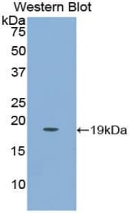 PGF / PLGF Antibody (aa43-162)