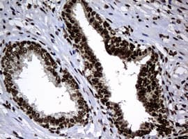 PCNA Antibody (clone OTI6A10)