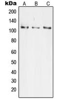 TAOK3 / JIK Antibody (Internal)