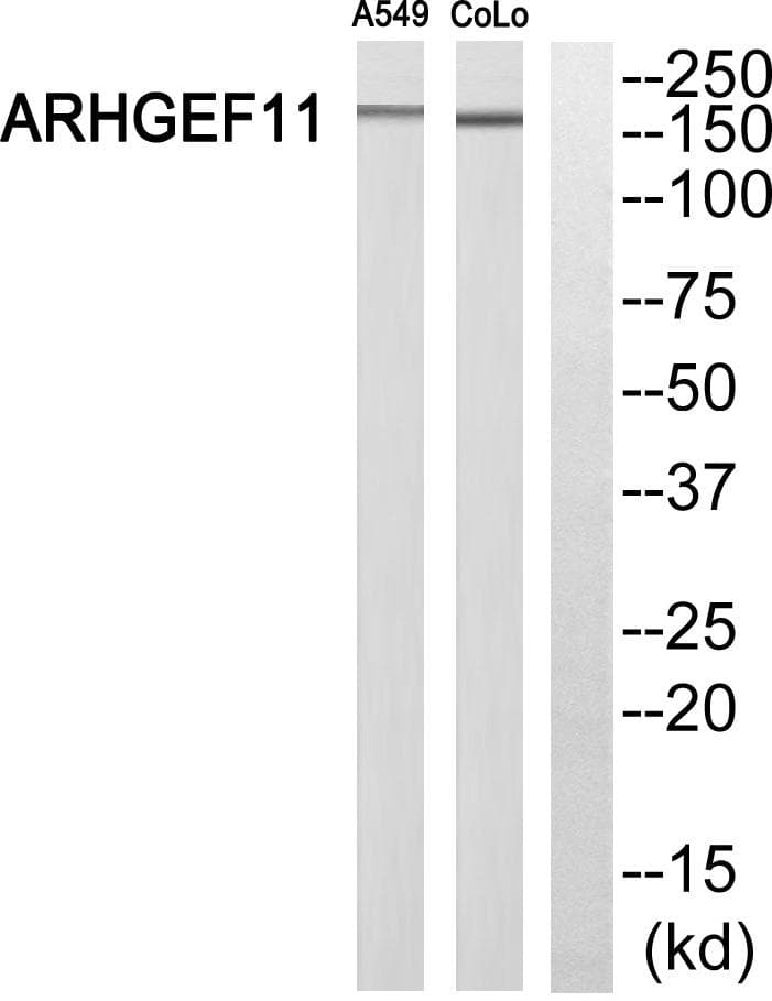 Polyclonal Rabbit anti-Human ARHGEF11 Antibody (WB)