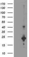 TP73-AS1 / KIAA0495 Antibody (clone OTI1F8)
