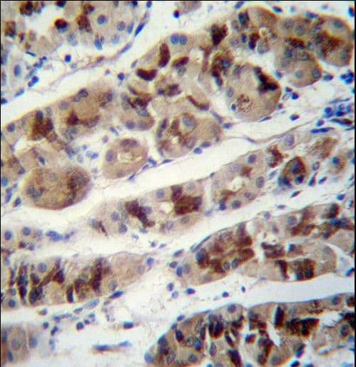 DDA1 Antibody (aa11-40)