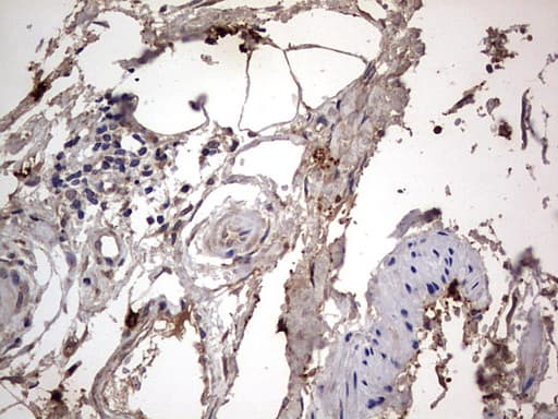 Monoclonal Mouse anti-Human SMPD1 / Acid Sphingomyelinase Antibody (clone OTI3H7, aa62-341, IHC, WB)