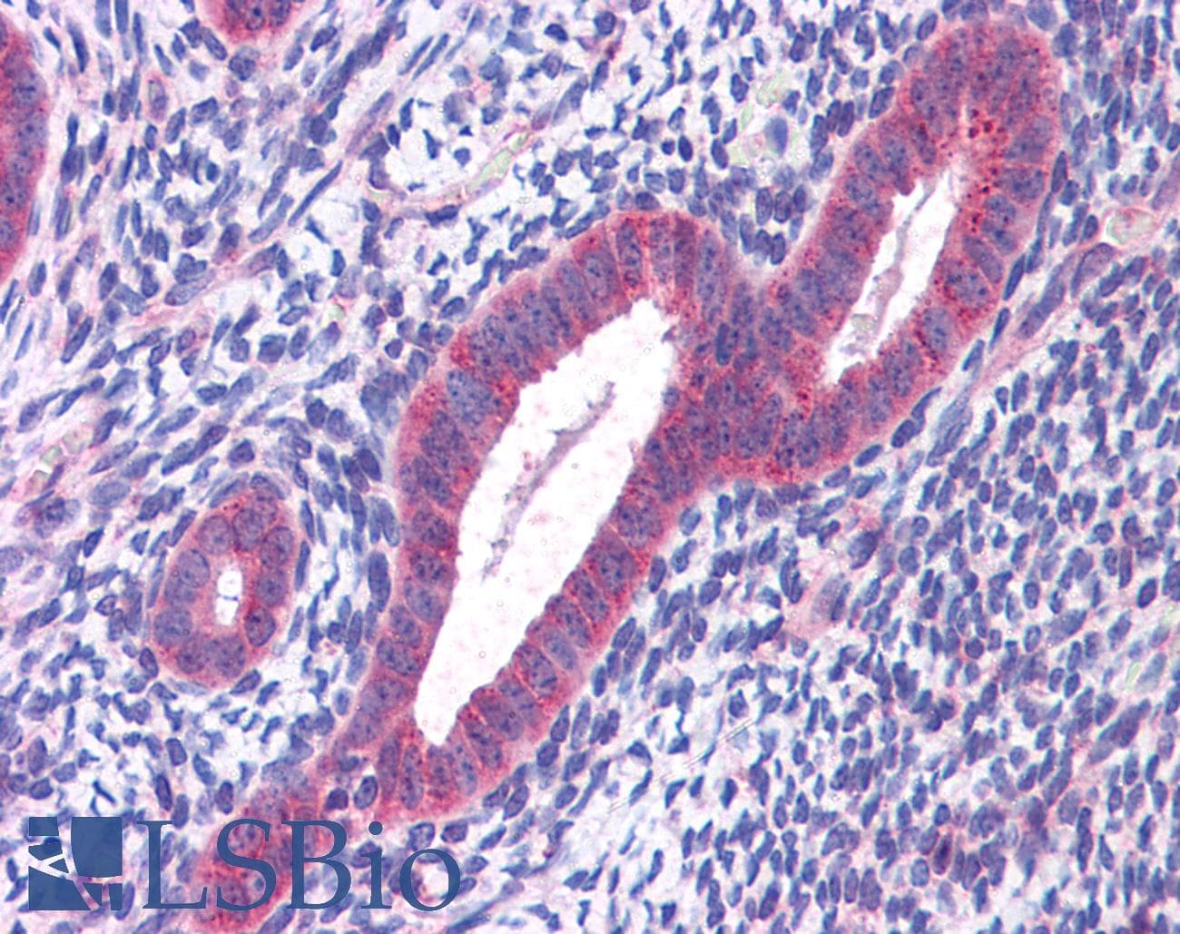 IHC-plus™ Polyclonal Rabbit anti-Human CCDC106 Antibody (IHC, IF, WB)