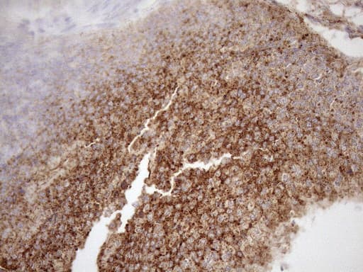 Monoclonal Mouse anti-Human KCTD9 Antibody (clone OTI2G8, aa1-223, IHC, WB)