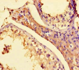 Polyclonal Rabbit anti-Human SETD1A / SET1 Antibody (IHC)