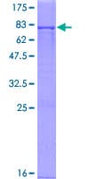 Human HGD Protein (Recombinant GST)