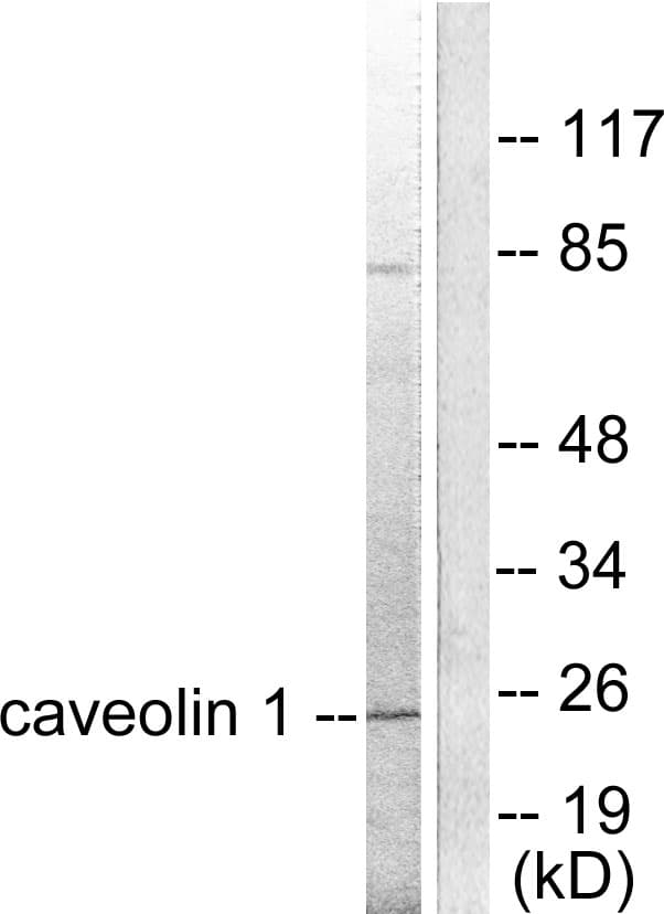 IHC-plus™ CAV1 / Caveolin 1 Antibody (aa129-178)