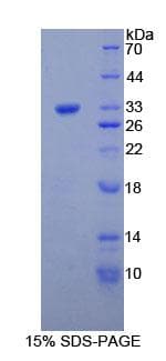 Mouse COL1A1 / Collagen I Alpha 1 Protein (Recombinant His, N-Terminal)