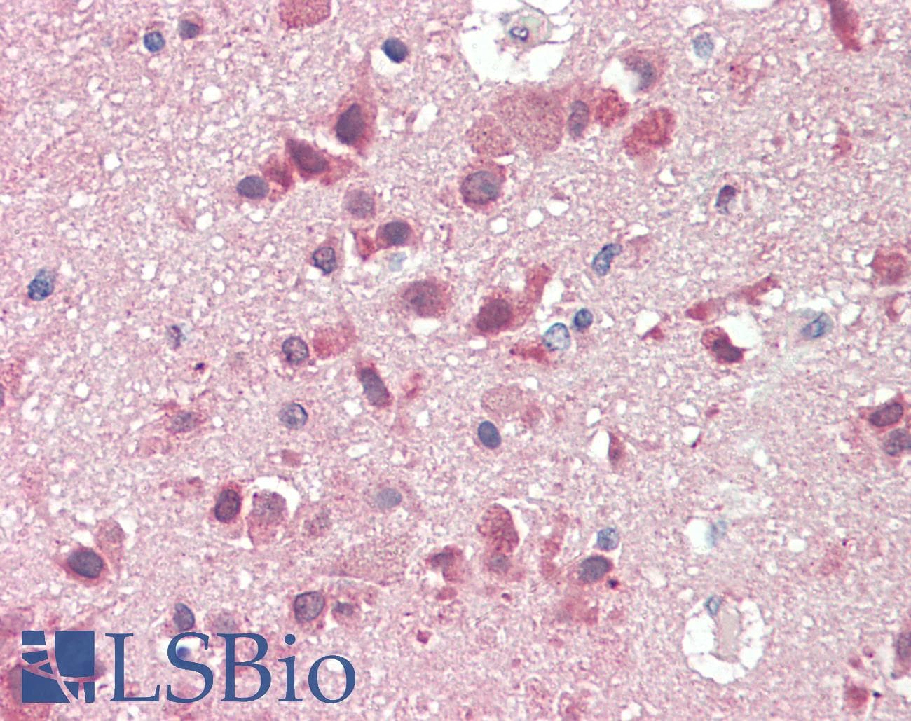 Polyclonal Rabbit anti-Human SLC38A2 / SNAT2 Antibody (aa35-84, IHC, WB)