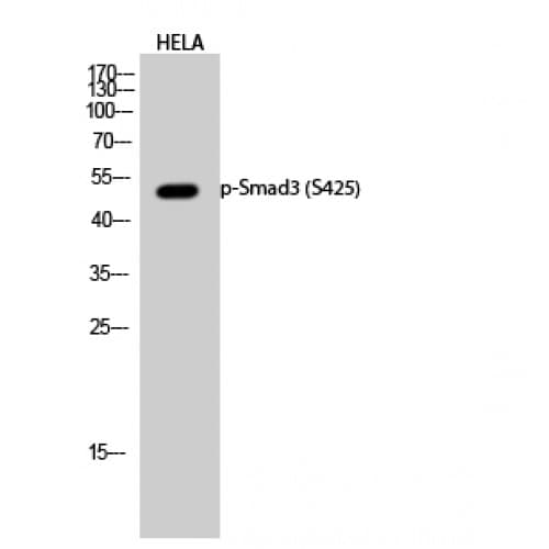 Polyclonal Rabbit anti-Human SMAD3 Antibody (350-430 aa, IHC, WB)