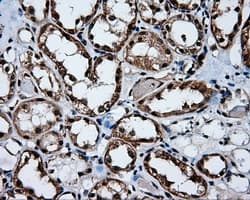 HMRF1L / MTRF1L Antibody (clone OTI1E3)