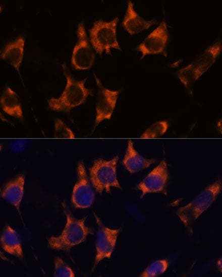 NDRG4 Antibody