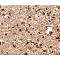 JPH4 Antibody