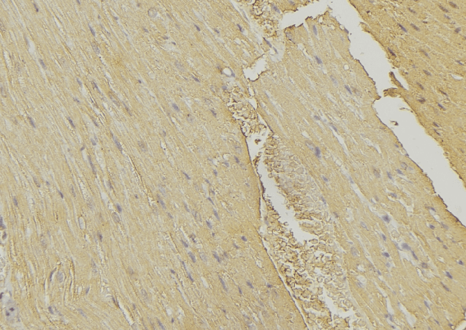 MVK Antibody