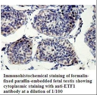 ETF1 / ERF1 Antibody (aa1-171)