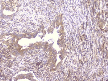 PCDH15 Antibody